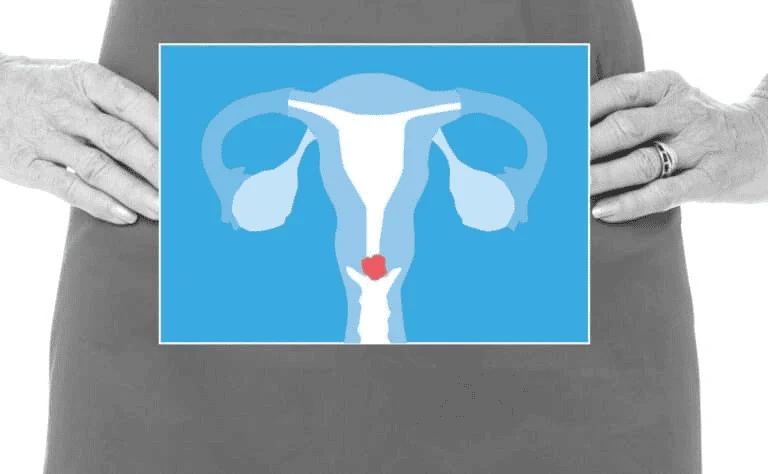 breaking barriers how immunotherapy and pioneering research are redefining cervical cancer treatment