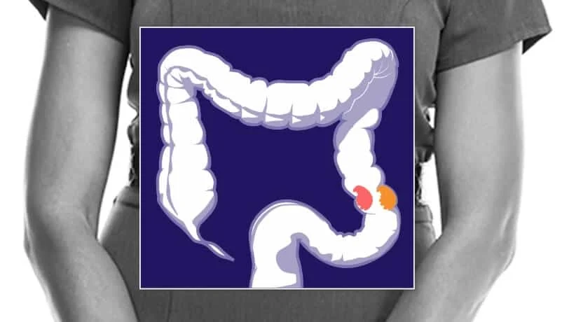 A New Frontier in Colorectal Cancer Immunotherapy: Dr. Karin Pelka Pioneers AI-Driven Research to Transform Outcomes for the Majority of Patients 1 a new frontier in colorectal cancer immunotherapy dr karin pelka pioneers ai driven research to transform outcomes for the majority of patients