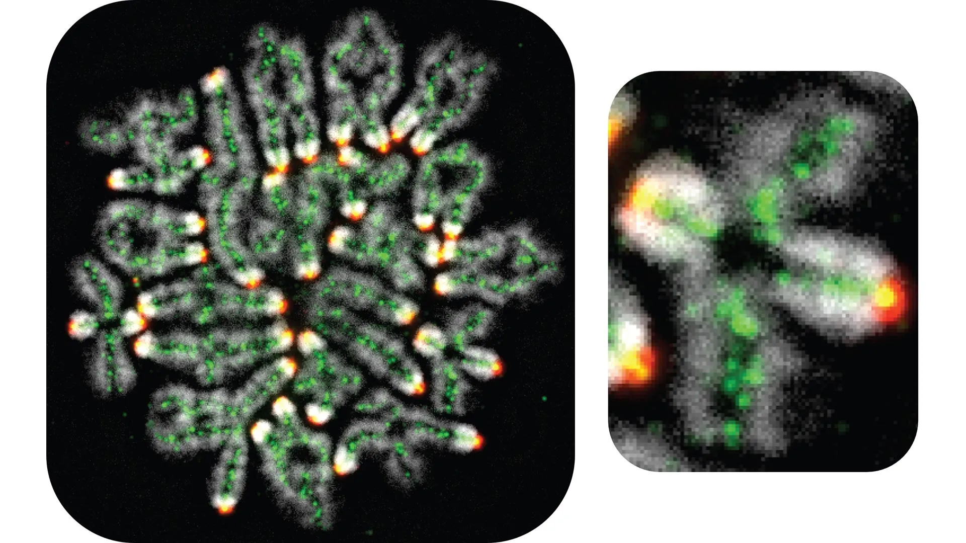 safeguarding the blueprint of life new research unveils the molecular choreography protecting chromosomal integrity in human reproduction