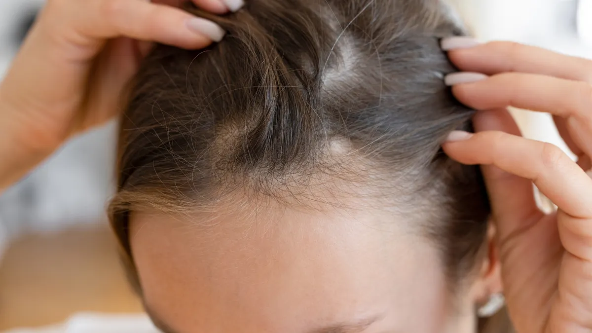 Veradermics keeps ‘momentum going’ as baldness drug helps women with hair loss 1 veradermics keeps momentum going as baldness drug helps women with hair loss