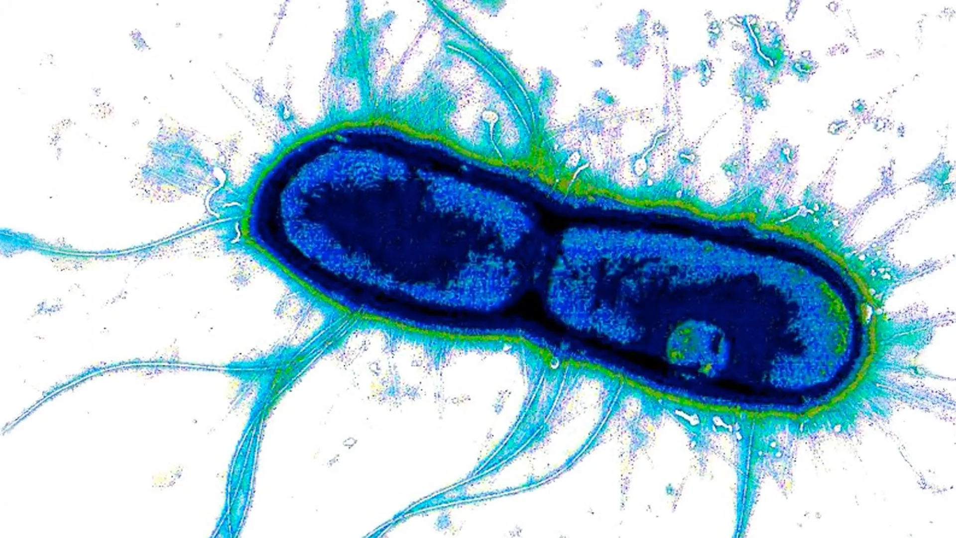 A Novel Vaccine Strategy Emerges for Two of the World's Deadliest Diarrheal Pathogens. 1 a novel vaccine strategy emerges for two of the worlds deadliest diarrheal pathogens