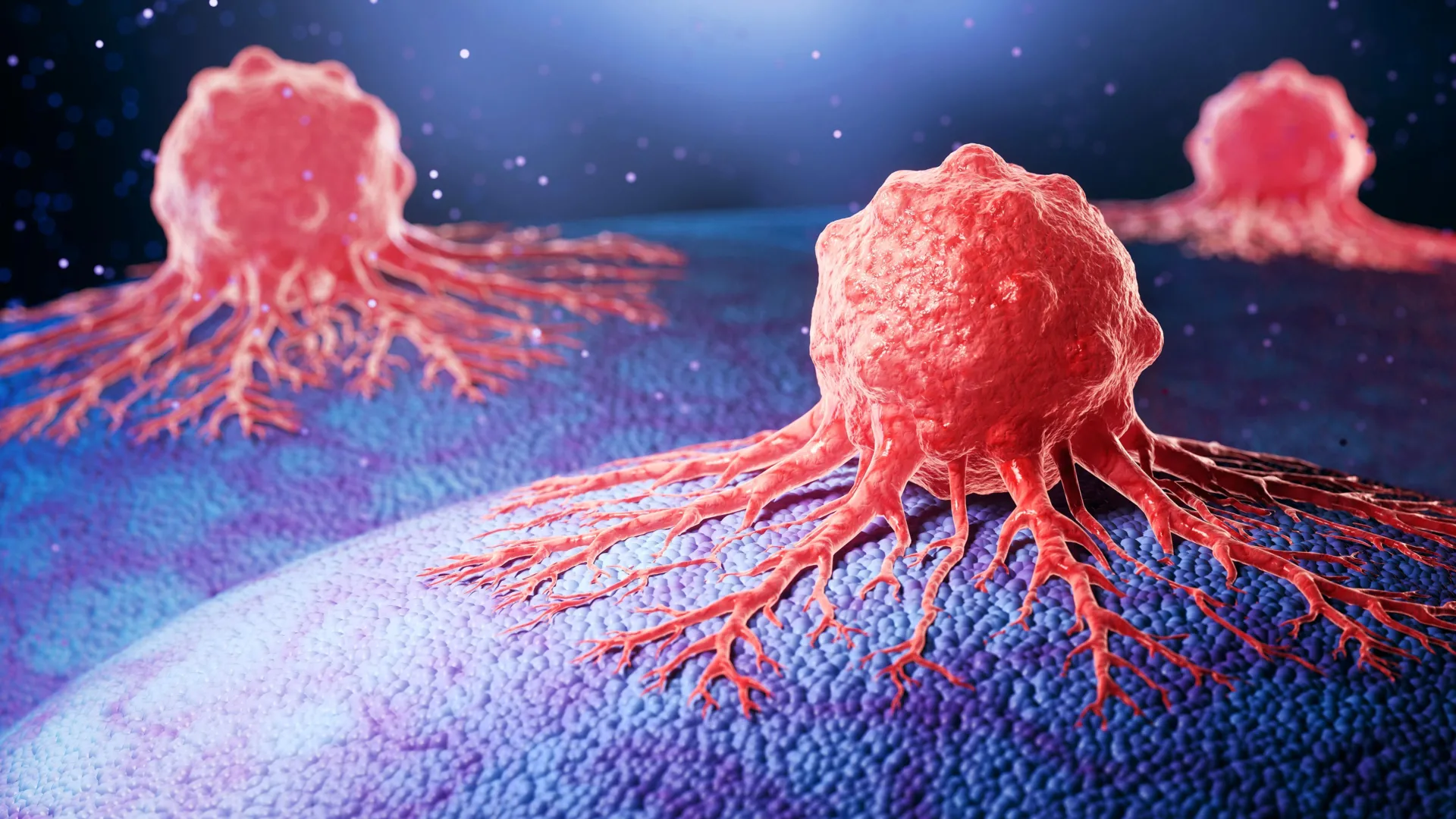 Brazilian Researchers Uncover Key Protein Driving Early Nerve Invasion in Pancreatic Cancer 1 brazilian researchers uncover key protein driving early nerve invasion in pancreatic cancer