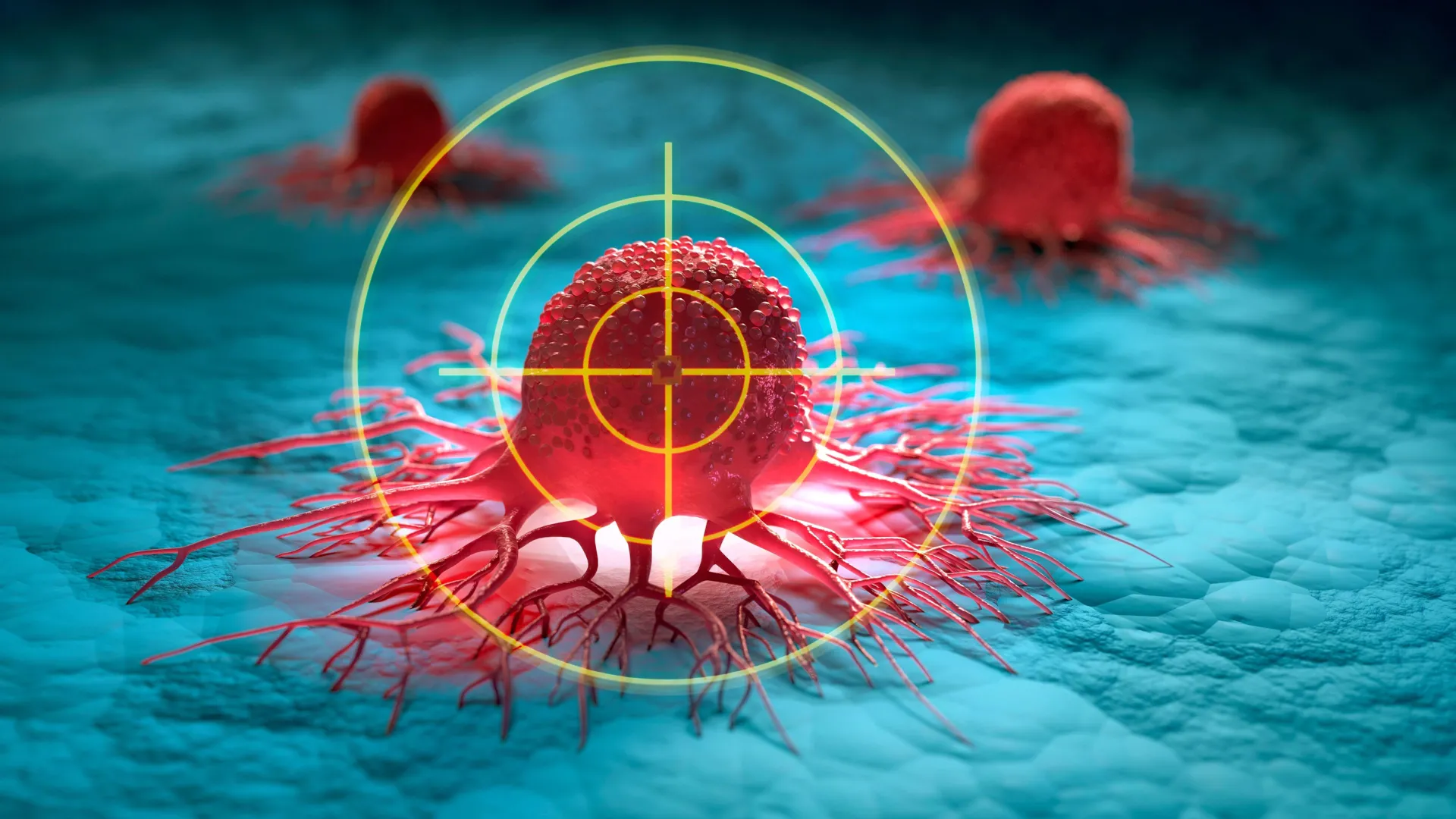experimental immunotherapy targets tumor associated macrophages to overcome metastatic cancer resistance