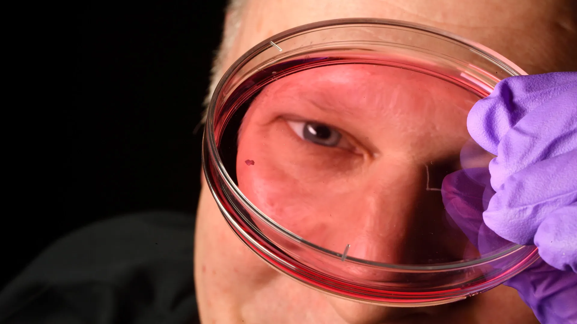 Johns Hopkins Scientists Uncover Fetal Origins of Sharp Central Vision, Challenging Old Theories and Paving Way for Macular Degeneration Therapies 1 johns hopkins scientists uncover fetal origins of sharp central vision challenging old theories and paving way for macular degeneration therapies