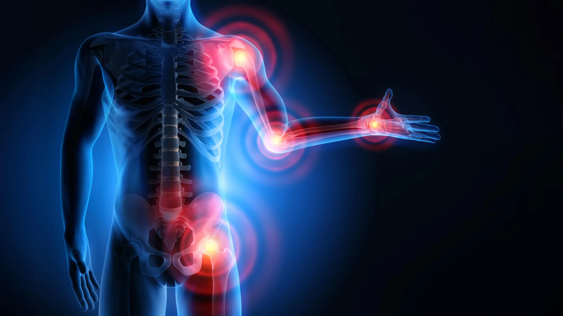 mcmaster researchers uncover immune metabolic pathway behind statin muscle pain paving way for enhanced cardiovascular treatment adherence