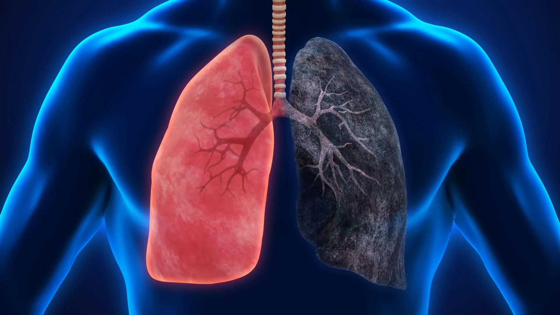 new study reveals fire smokes profound impact on immune system at cellular level