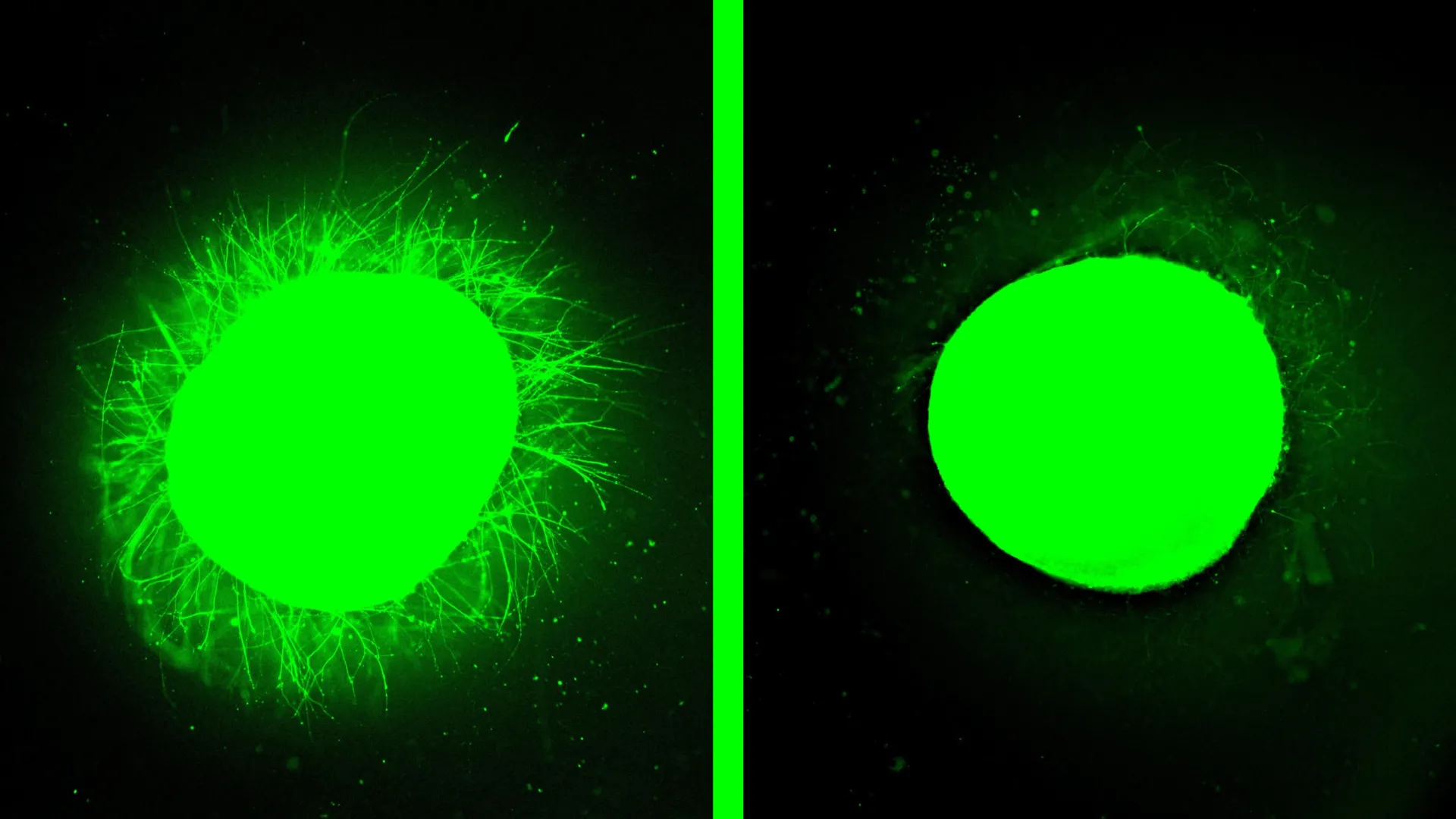 northwestern scientists unveil groundbreaking human spinal cord injury model and promising regenerative therapy
