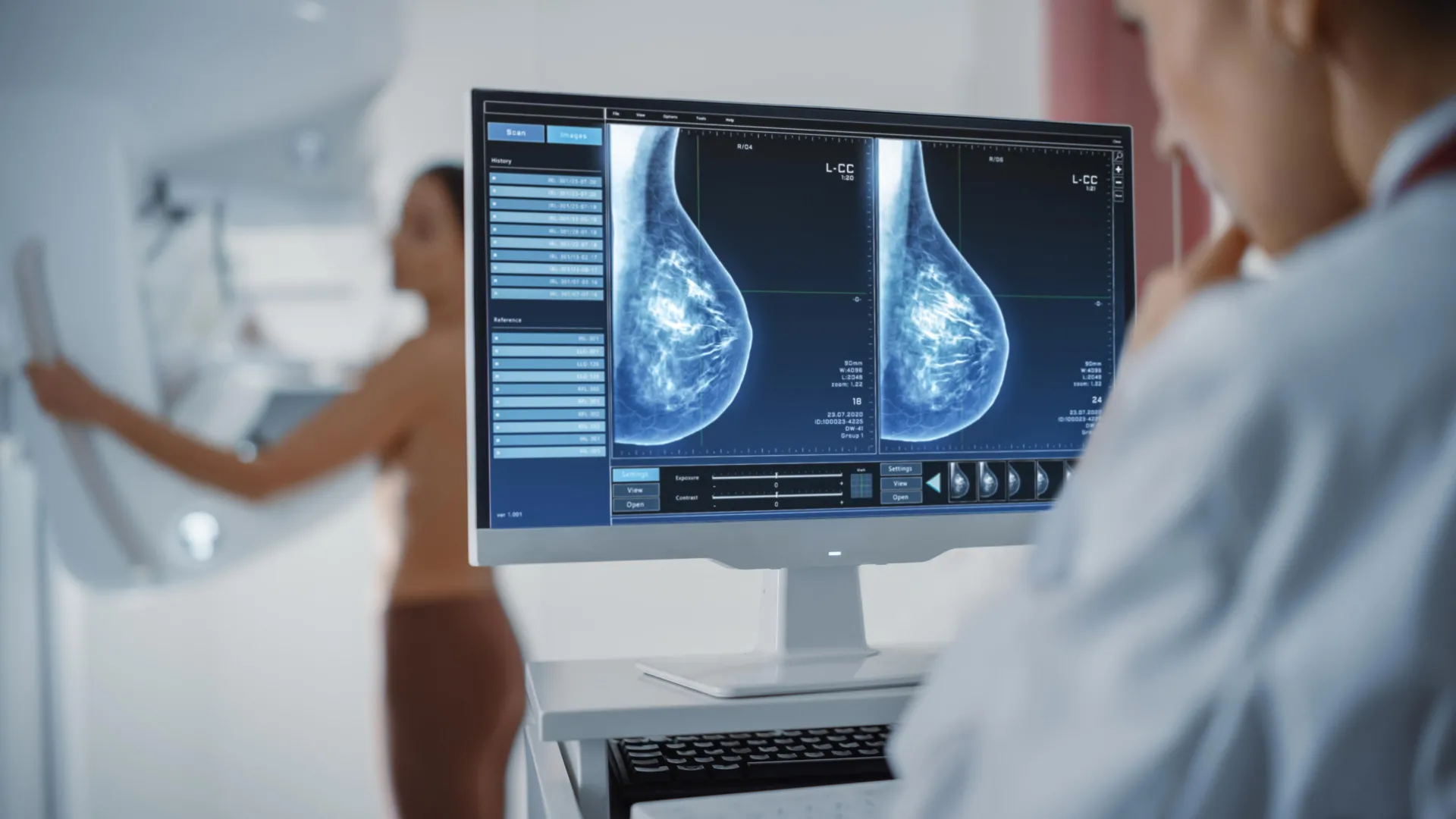 personalized breast cancer screening proves safer and more effective in landmark wisdom study