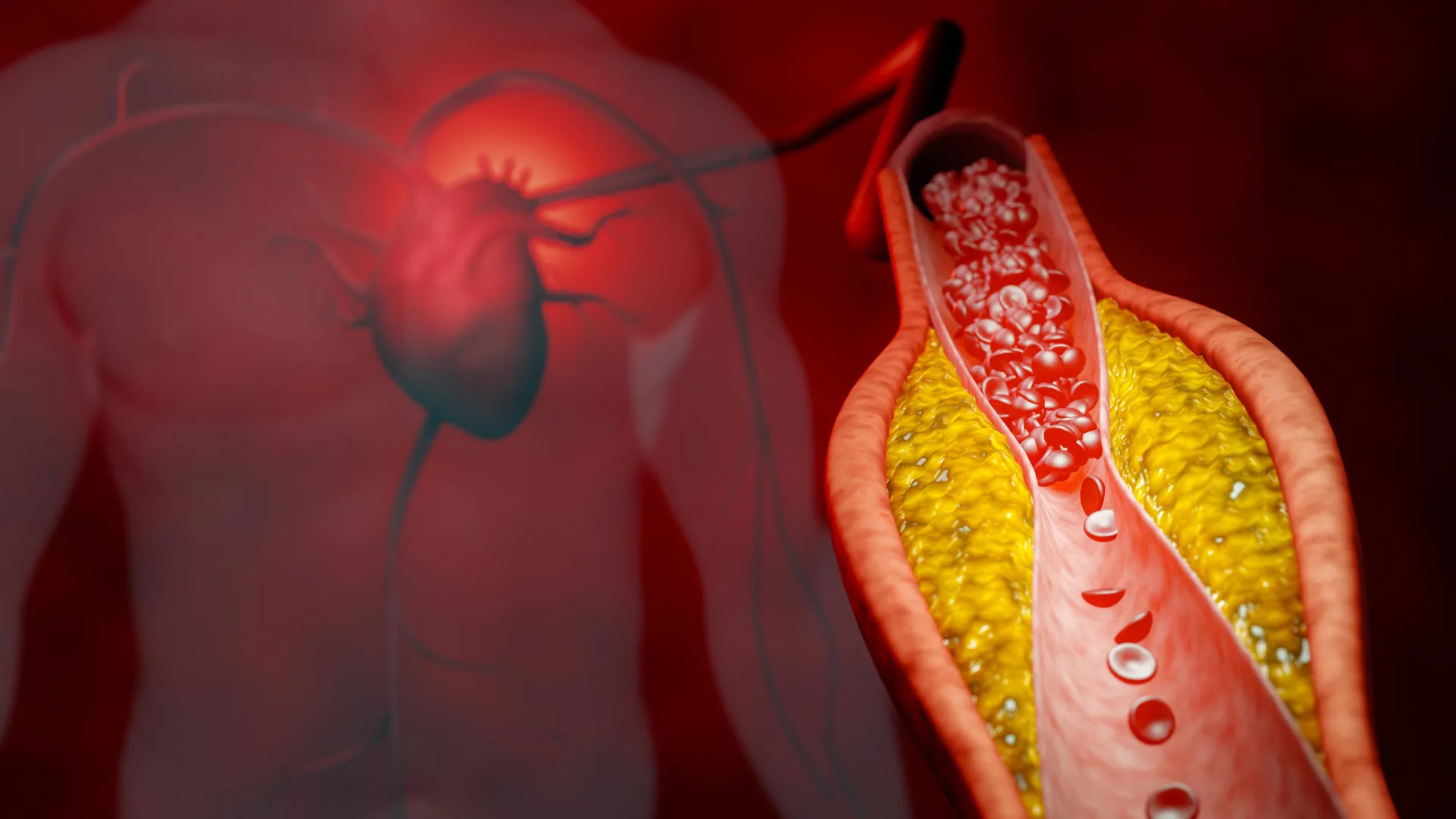 rethinking cholesterol management new northwestern study suggests apob test superior for predicting heart attack and stroke risk