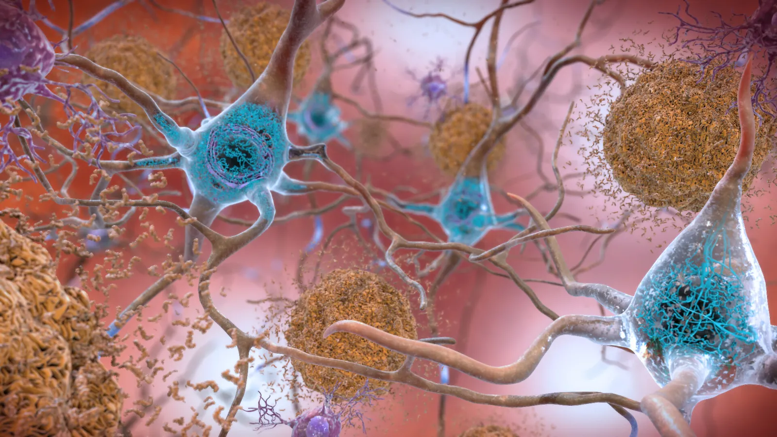 roche eli lilly get fda nod for new alzheimers blood test