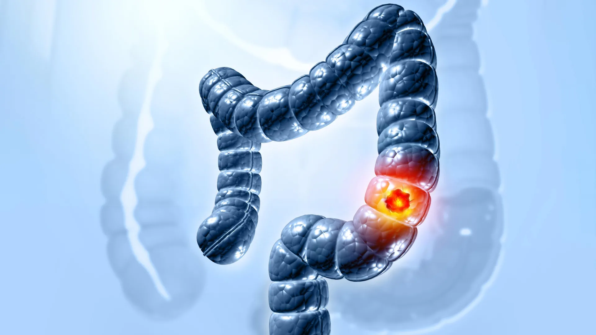 scientists uncover key mechanism of gut toxin in colorectal cancer development paving way for novel prevention strategies