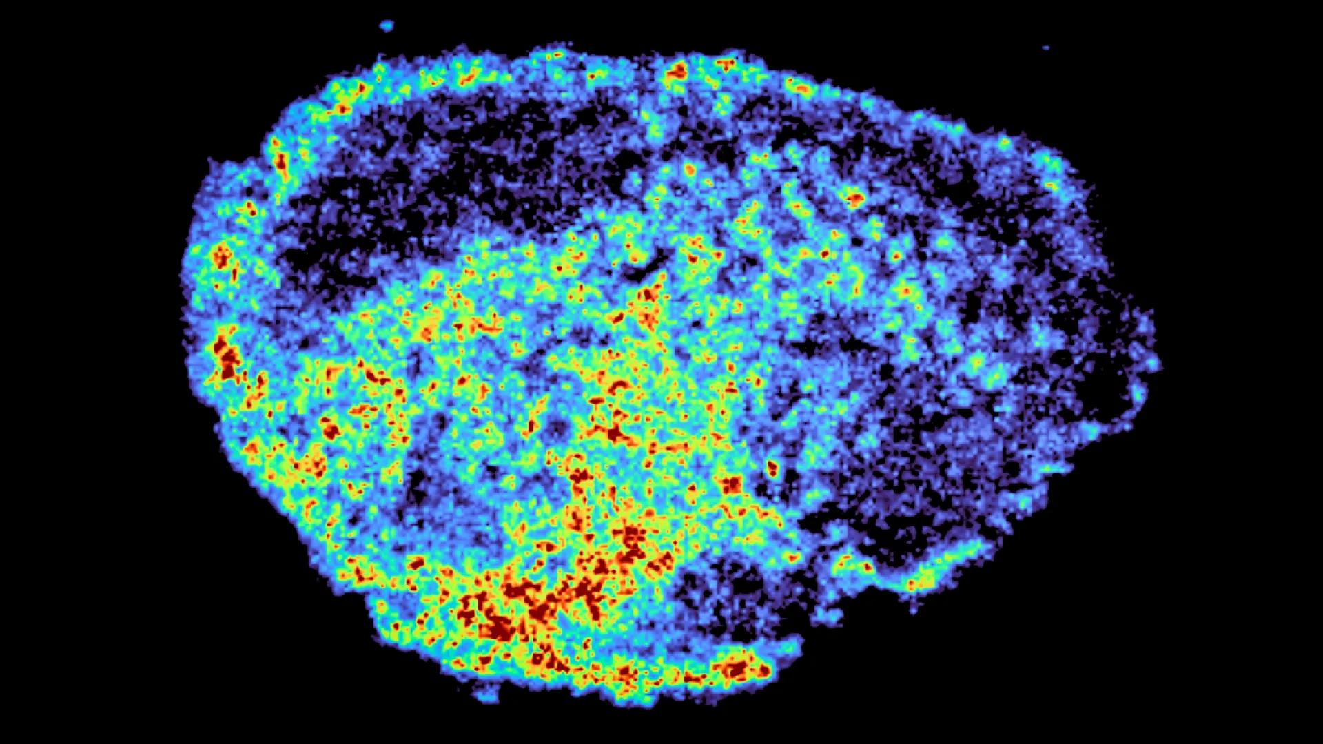 Spatial Mapping of PARP Inhibitors Reveals Lysosomal Sequestration as a Key Driver of Treatment Variability in Ovarian Cancer 1 spatial mapping of parp inhibitors reveals lysosomal sequestration as a key driver of treatment variability in ovarian cancer