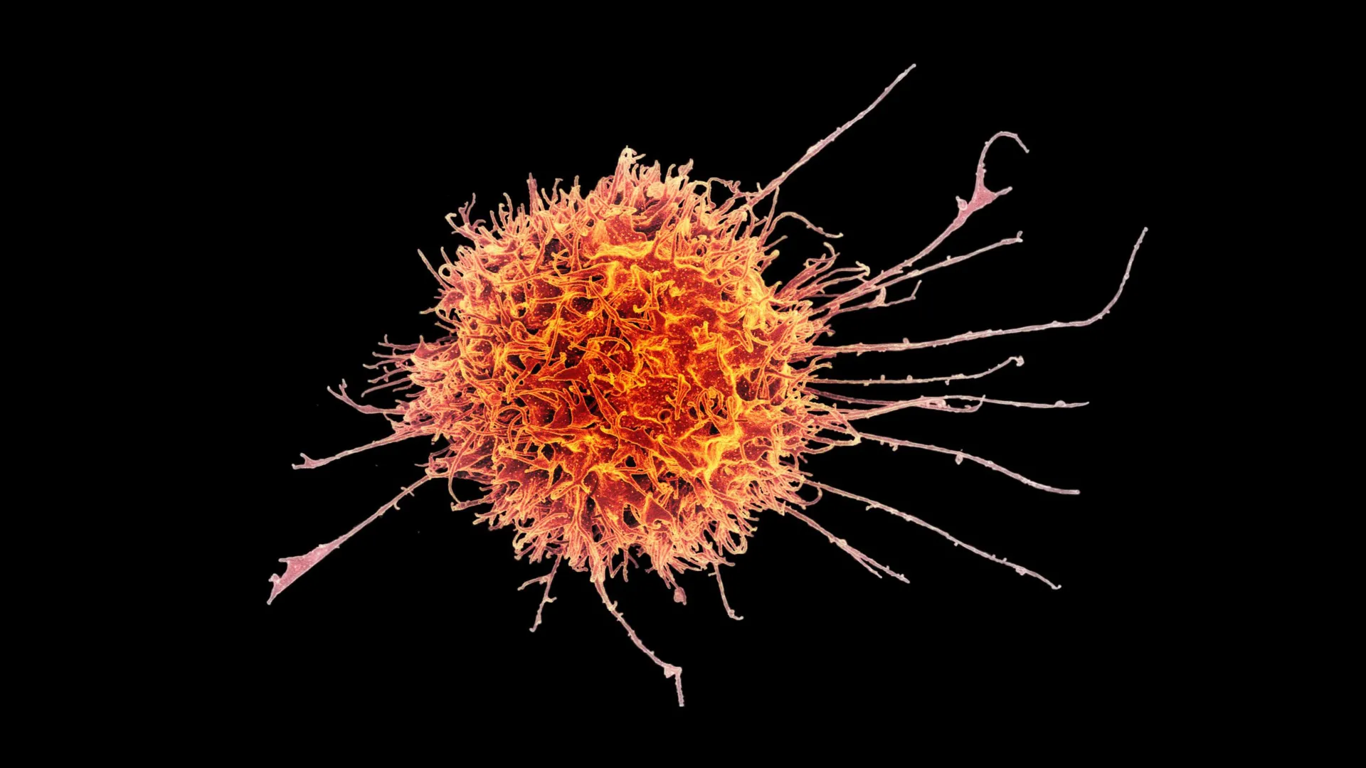 stanford researchers engineer tissue resident natural killer cells to penetrate and destroy solid tumors