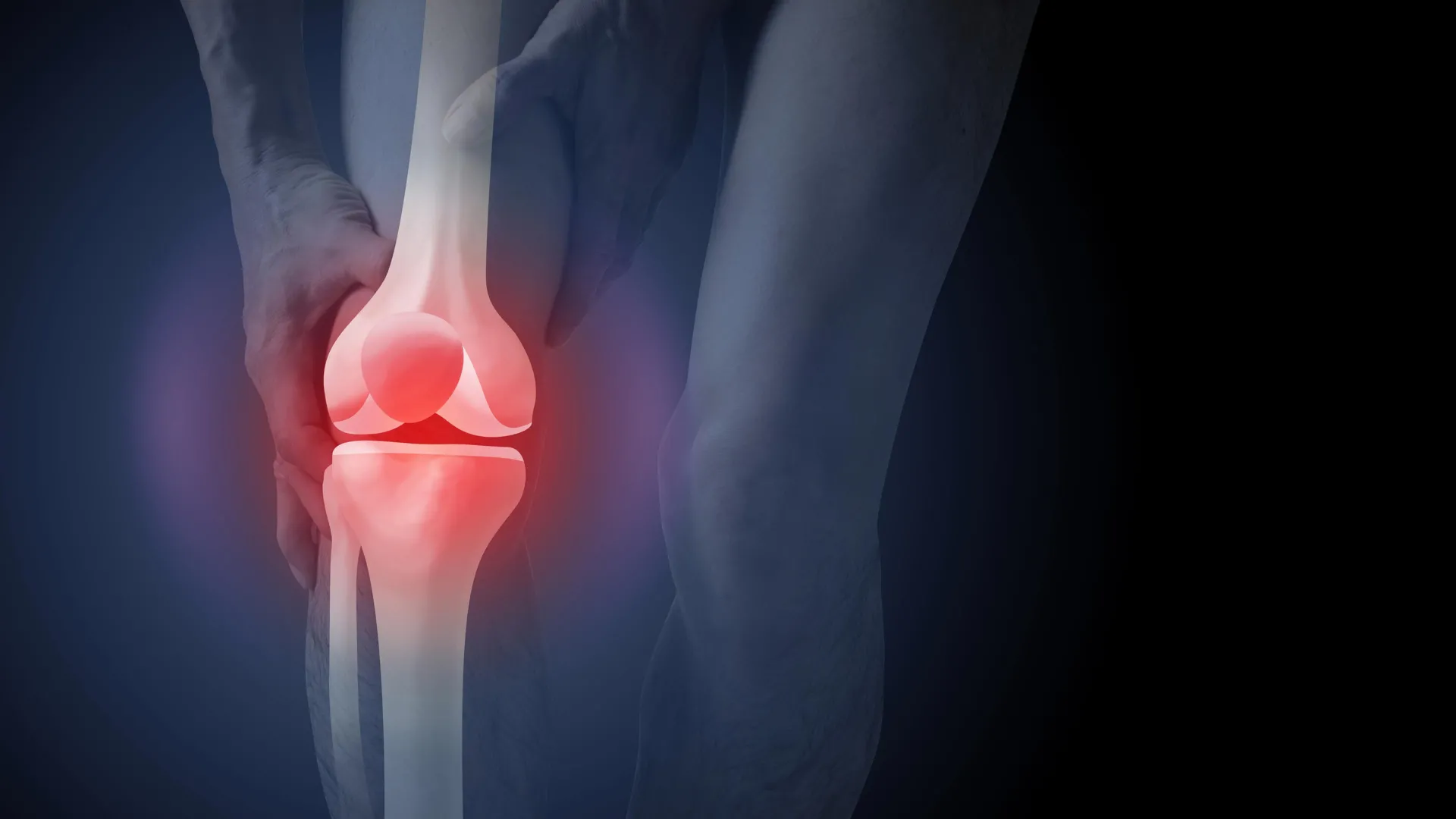 unnecessary x rays for knee osteoarthritis fuel surgery demand and patient anxiety study finds