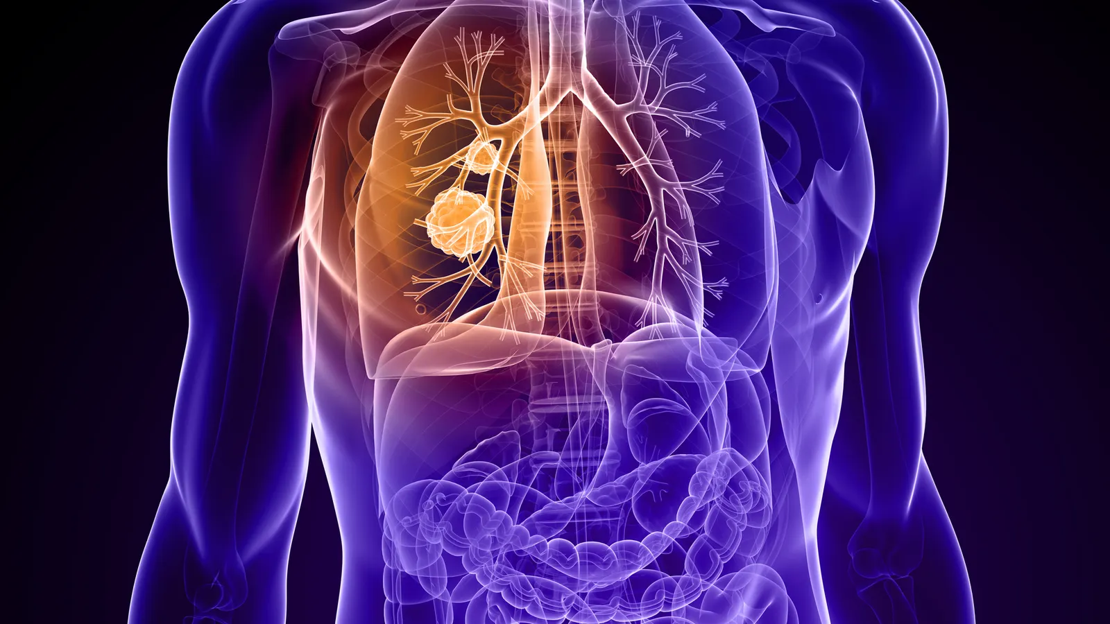 zipalertinib emerges as potent challenger in egfr exon 20 nsclc treatment landscape setting new standards for efficacy and market competition
