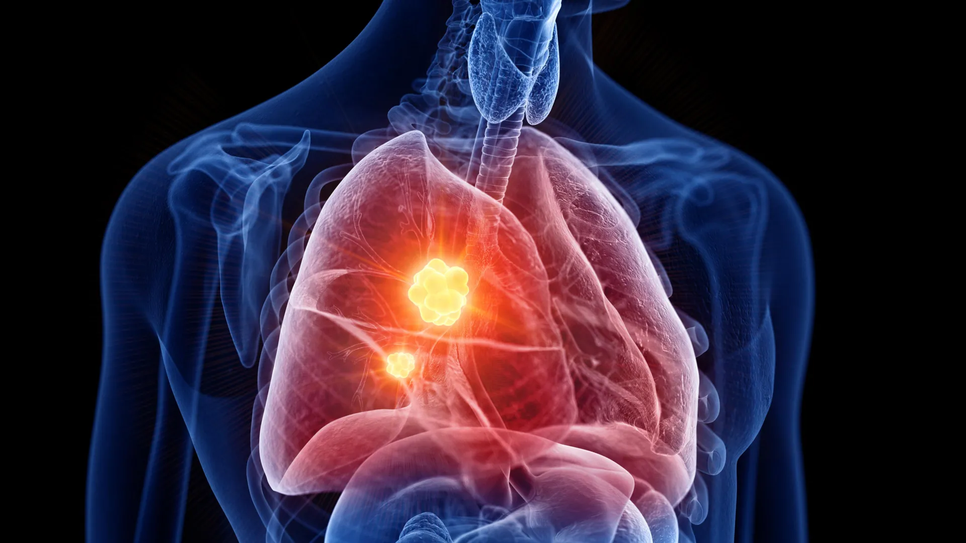 new mesothelioma drug turns cancers own defenses against it