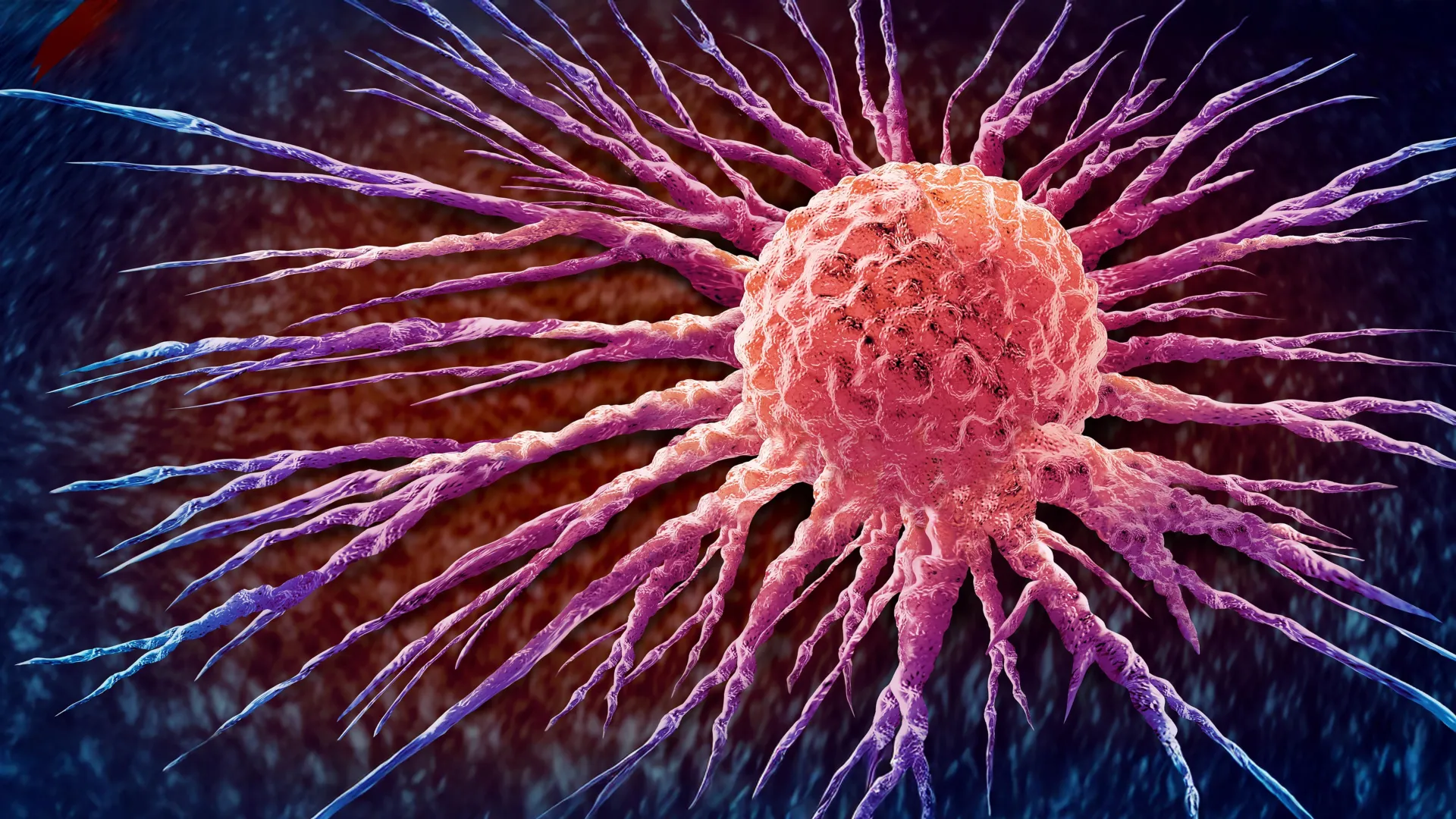 The Global Cancer Crisis: A Ticking Time Bomb Requiring Urgent, Equitable Action 1 the global cancer crisis a ticking time bomb requiring urgent equitable action