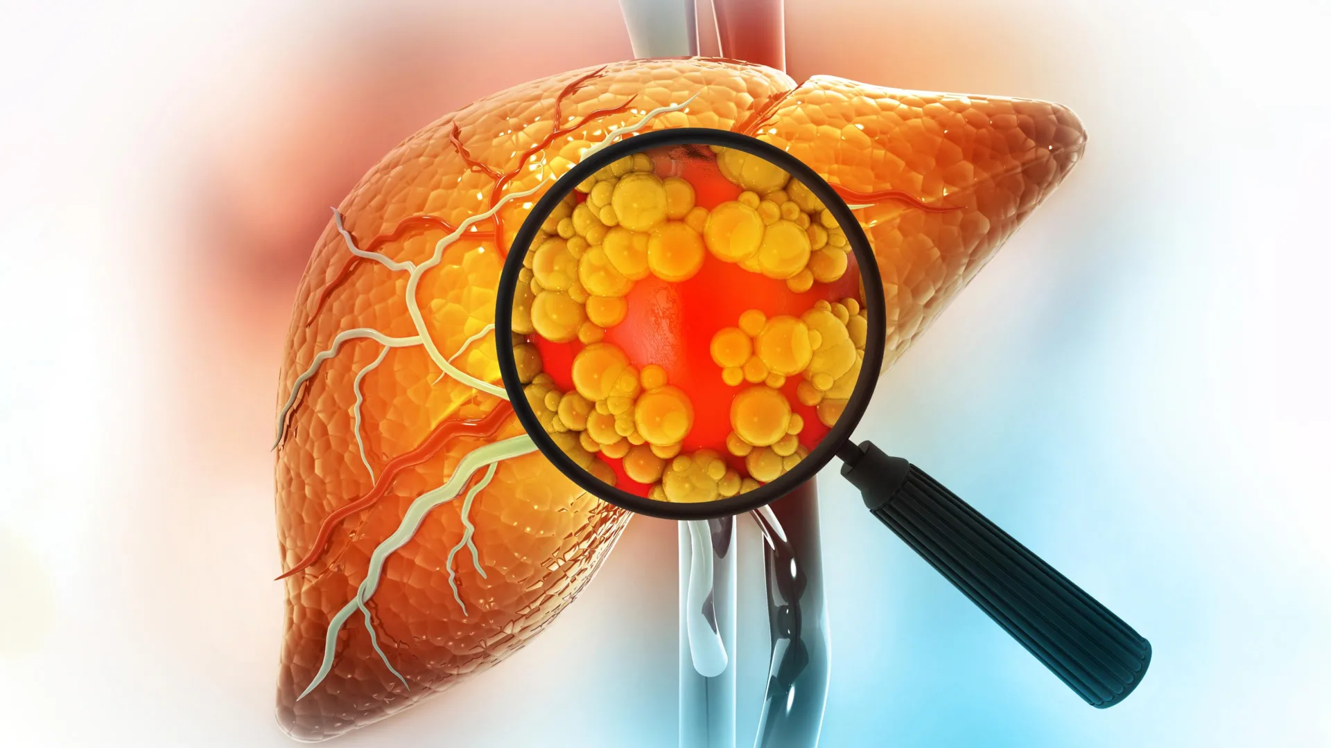 Low testosterone may make sugar far more harmful to your liver 1 low testosterone may make sugar far more harmful to your liver